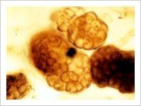 800 million year old fossils of cyanobacteria, Spitsbergen (each cell about 4 microns in diameter)
